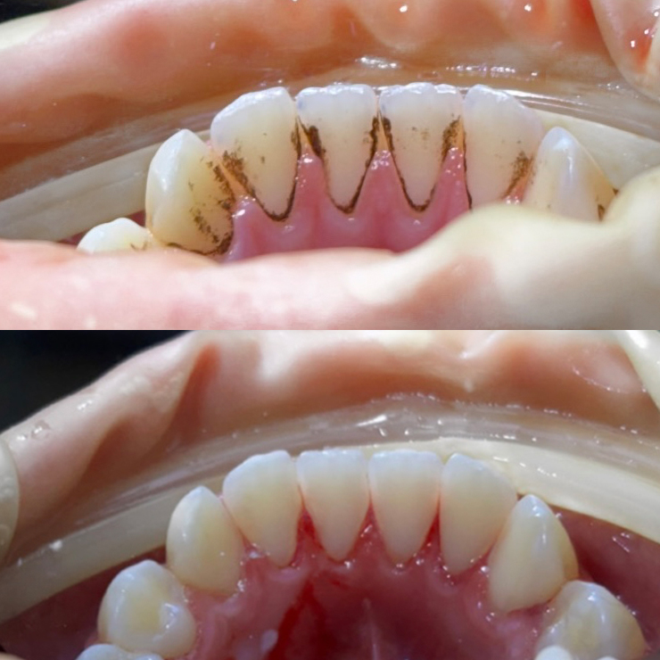 Профессиональная гигиена полости рта