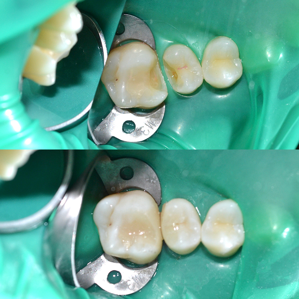 Профессиональная гигиена полости рта