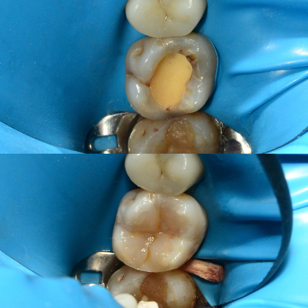 Профессиональная гигиена полости рта