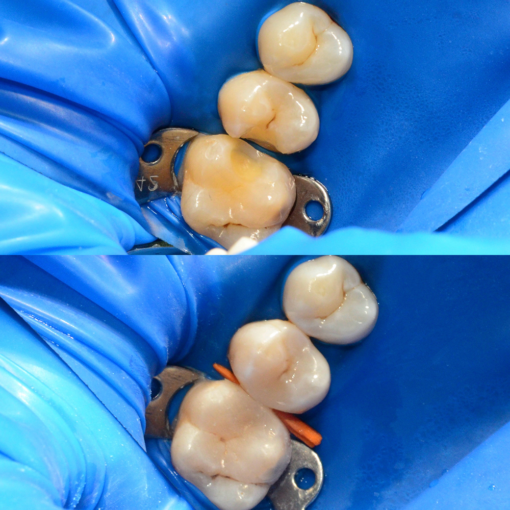 Профессиональная гигиена полости рта