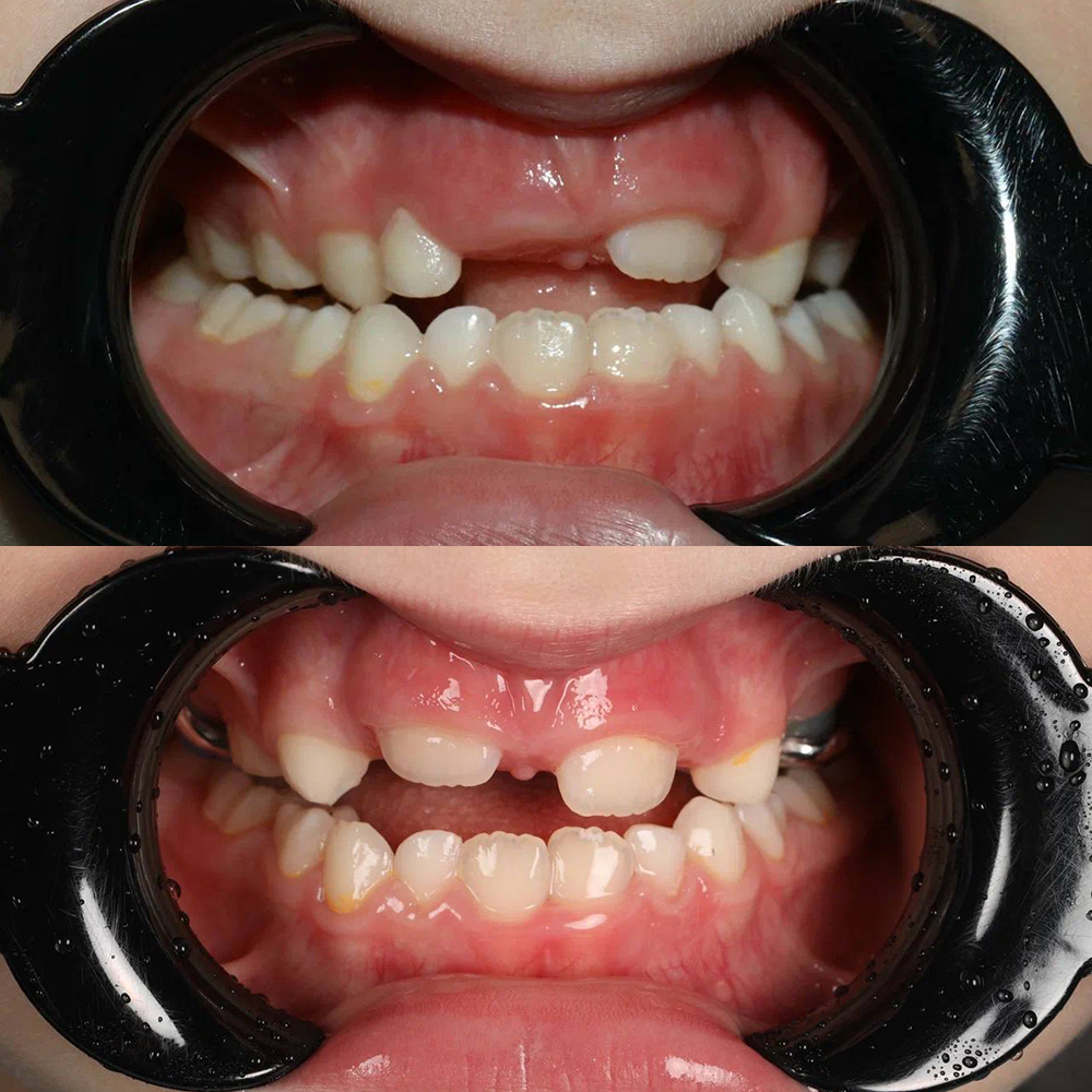 Профессиональная гигиена полости рта